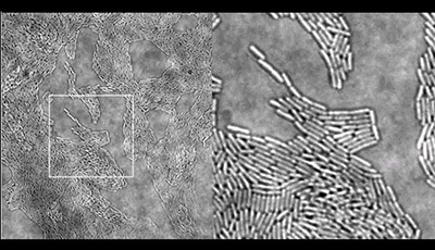 image of Pseudomonas aeruginosa Twitching Motility: Type IV Pili in Action: Supplemental Video 1