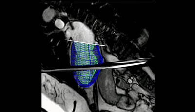 image of Cardiovascular Magnetic Resonance: Deeper Insights Through Bioengineering: Figure 2