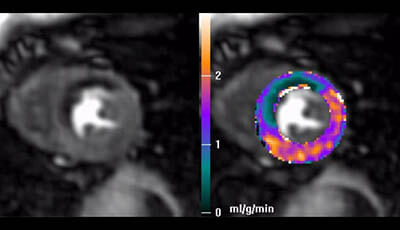 image of Cardiovascular Magnetic Resonance: Deeper Insights Through Bioengineering: Figure 3: Stress