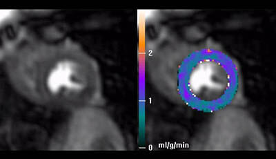 image of Cardiovascular Magnetic Resonance: Deeper Insights Through Bioengineering: Figure 3: Rest