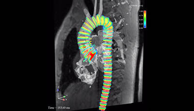 image of Cardiovascular Magnetic Resonance: Deeper Insights Through Bioengineering: Figure 5