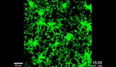 image of Microglia Development and Function: Supplemental Video a1