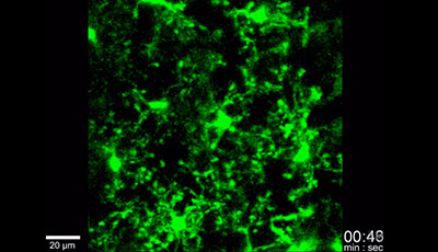 image of Microglia Development and Function: Supplemental Video a2