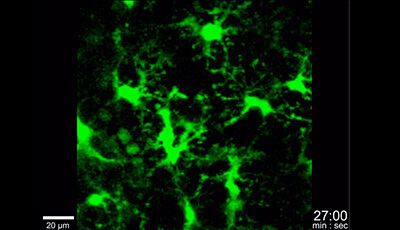 image of Microglia Development and Function: Supplemental Video b