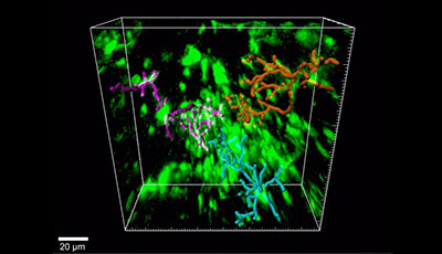 image of Microglia Development and Function: Supplemental Video c