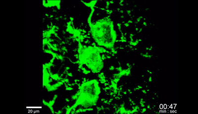 image of Microglia Development and Function: Supplemental Video e