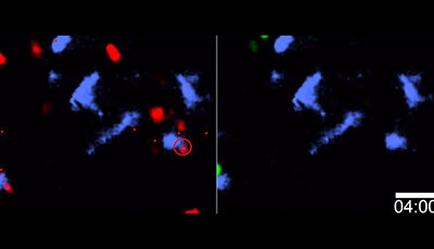 image of Spatiotemporal Basis of Innate and Adaptive Immunity in Secondary Lymphoid Tissue: Video 11