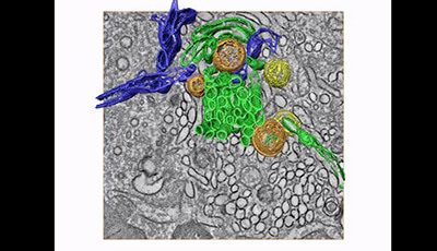 image of Three-Dimensional Imaging of Viral Infections: Video 5