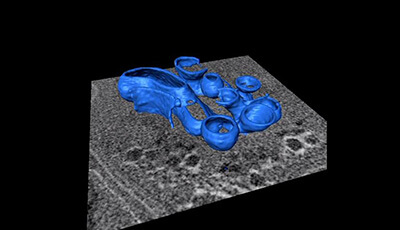 image of Three-Dimensional Imaging of Viral Infections: Video 6