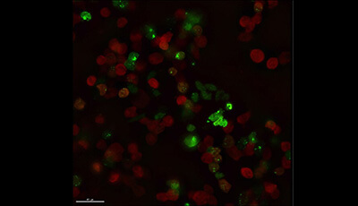 image of Cytoplasmic RNA Granules and Viral Infection: Video 1