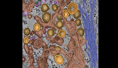 image of Flaviviridae Replication Organelles: Oh, What a Tangled Web We Weave: Video 2