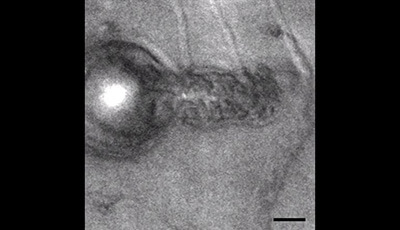 image of Adaptive Optics Ophthalmoscopy: Figure 9