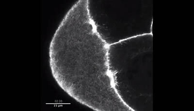 image of Cytoplasmic Streaming in the Drosophila Oocyte: Video 5